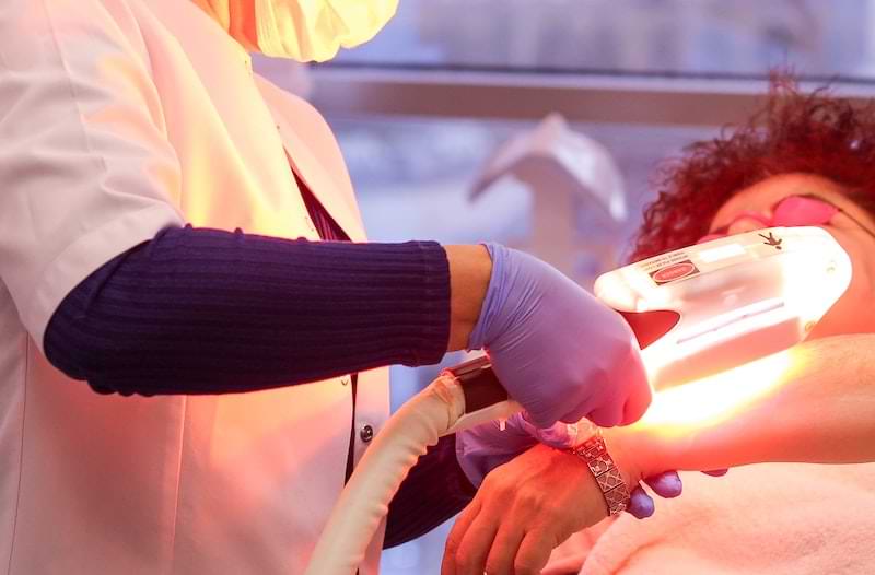 dye laser come funziona | Ialuronico Milano